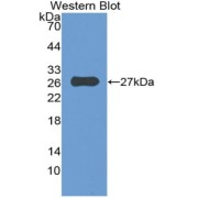 Western blot analysis of the recombinant protein.