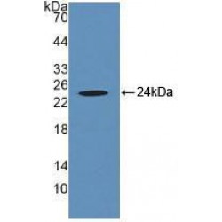 Crystallin Alpha B (CRYaB) Antibody