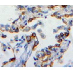 Carcinoembryonic Antigen Related Cell Adhesion Molecule 6 (CEACAM6) Antibody