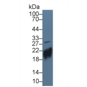 Western blot analysis of Human JAR cell lysate, using Human CGb Antibody (5 µg/ml) and HRP-conjugated Goat Anti-Rabbit antibody (<a href="https://www.abbexa.com/index.php?route=product/search&amp;search=abx400043" target="_blank">abx400043</a>, 0.2 µg/ml).