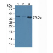 Western blot analysis of (1) Human Liver Tissue, (2) Human Lung Tissue and (3) Rat Heart Tissue.