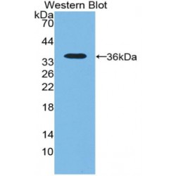 5'-Nucleotidase, Cytosolic III (NT5C3) Antibody