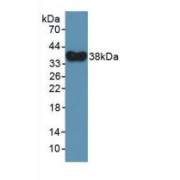 Western blot analysis of recombinant Human DEFa4.