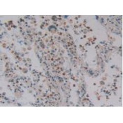 Defensin Alpha 4, Corticostatin (DEFa4) Antibody