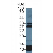 Western blot analysis of Human Lung lysate, using Human SOSTDC1 Antibody (5 µg/ml) and HRP-conjugated Goat Anti-Rabbit antibody (<a href="https://www.abbexa.com/index.php?route=product/search&amp;search=abx400043" target="_blank">abx400043</a>, 0.2 µg/ml).