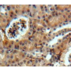 Sclerostin Domain Containing Protein 1 (SOSTDC1) Antibody