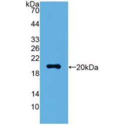 Visinin Like Protein 1 (VSNL1) Antibody