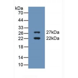 Cold Inducible RNA Binding Protein (CIRBP) Antibody