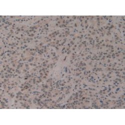 Cold Inducible RNA Binding Protein (CIRBP) Antibody