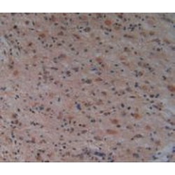 p21 Protein Activated Kinase 1 (PAK1) Antibody