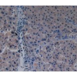 p21 Protein Activated Kinase 1 (PAK1) Antibody