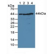 Western blot analysis of (1) Human Lung Tissue, (2) Human HeLa cells, (3) Human MCF7 Cells and (4) Human 293T Cells.
