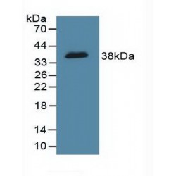 DNA Fragmentation Factor Subunit Alpha (DFFa) Antibody
