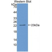 Western blot analysis of recombinant Human CD27BP.
