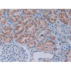 Apoptosis Regulatory Protein Siva / CD27BP (SIVA1) Antibody