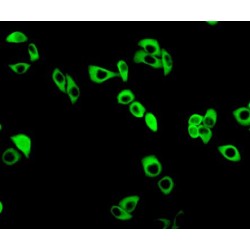 Glutamate Cysteine Ligase, Modifier Subunit (GCLM) Antibody