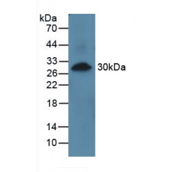 Prolylcarboxypeptidase (PRCP) Antibody