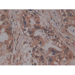 Prolylcarboxypeptidase (PRCP) Antibody