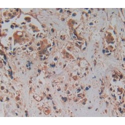 Prolylcarboxypeptidase (PRCP) Antibody