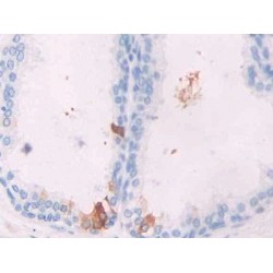 Gremlin 1 (GREM1) Antibody