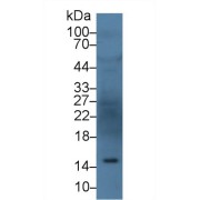 abx128903