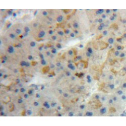 Angiogenin (ANG) Antibody