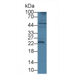 Insulin Like Growth Factor 1 (IGF1) Antibody