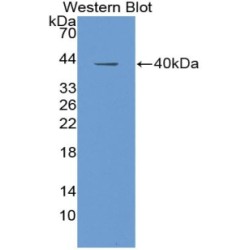 Insulin Like Growth Factor 1 (IGF1) Antibody