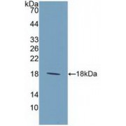 Western blot analysis of recombinant Human IL9.