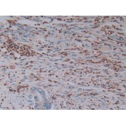 Granzyme B (GZMB) Antibody