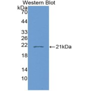 abx128922