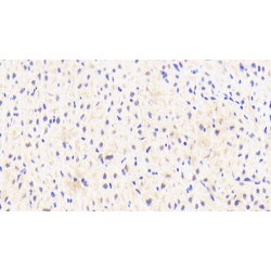 Chemokine C-C-Motif Ligand 1 (CCL1) Antibody