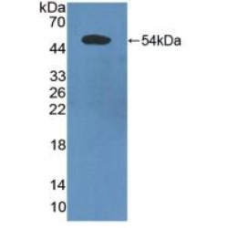 Programmed Cell Death 6-Interacting Protein (PDCD6IP) Antibody