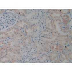 Programmed Cell Death 6-Interacting Protein (PDCD6IP) Antibody