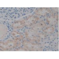 Programmed Cell Death 6-Interacting Protein (PDCD6IP) Antibody