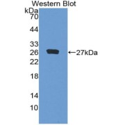 Western blot analysis of the recombinant protein.