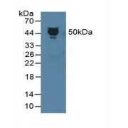 Western blot analysis of Human Serum.