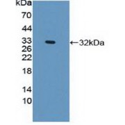 Western blot analysis of recombinant Human PLEC.