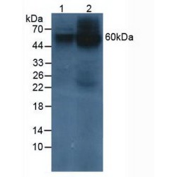Prosaposin (PSAP) Antibody