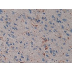 Prosaposin (PSAP) Antibody