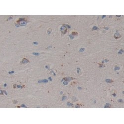 Prosaposin (PSAP) Antibody