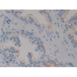 Prosaposin (PSAP) Antibody