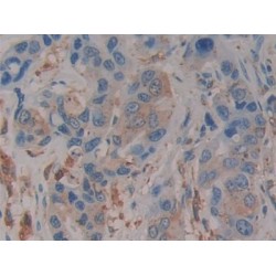 Prosaposin (PSAP) Antibody