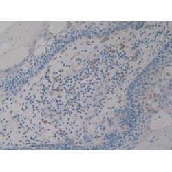Prosaposin (PSAP) Antibody