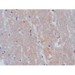 Sodium-Dependent Serotonin Transporter (SLC6A4) Antibody