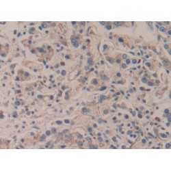 Amyloid Beta Precursor Protein Binding Protein A2 (APBA2) Antibody