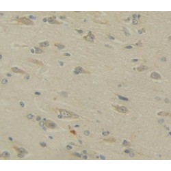 Amyloid Beta Precursor Protein Binding Protein A2 (APBA2) Antibody