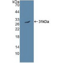 5'-AMP-Activated Protein Kinase Catalytic Subunit Alpha-2 (PRKAA2) Antibody