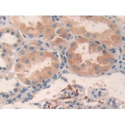 5'-AMP-Activated Protein Kinase Catalytic Subunit Alpha-2 (PRKAA2) Antibody
