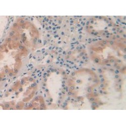 5'-AMP-Activated Protein Kinase Catalytic Subunit Alpha-2 (PRKAA2) Antibody